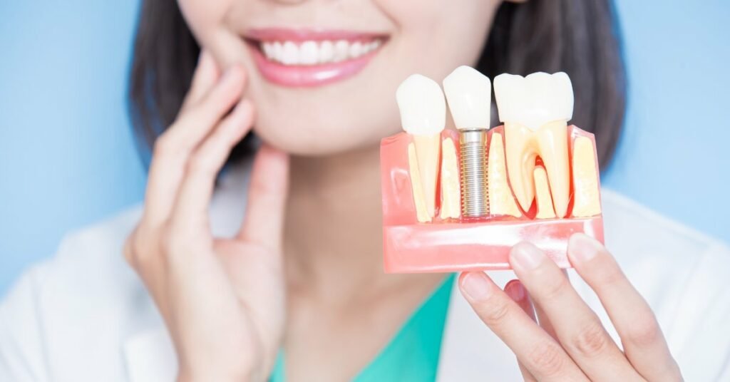 How Dental Implants Can Improve Your Quality of Life