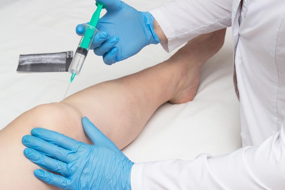 Stem Cell Injections