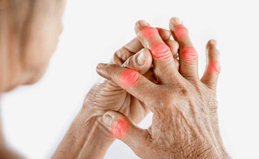 best pain management clinics for arthritis relief
