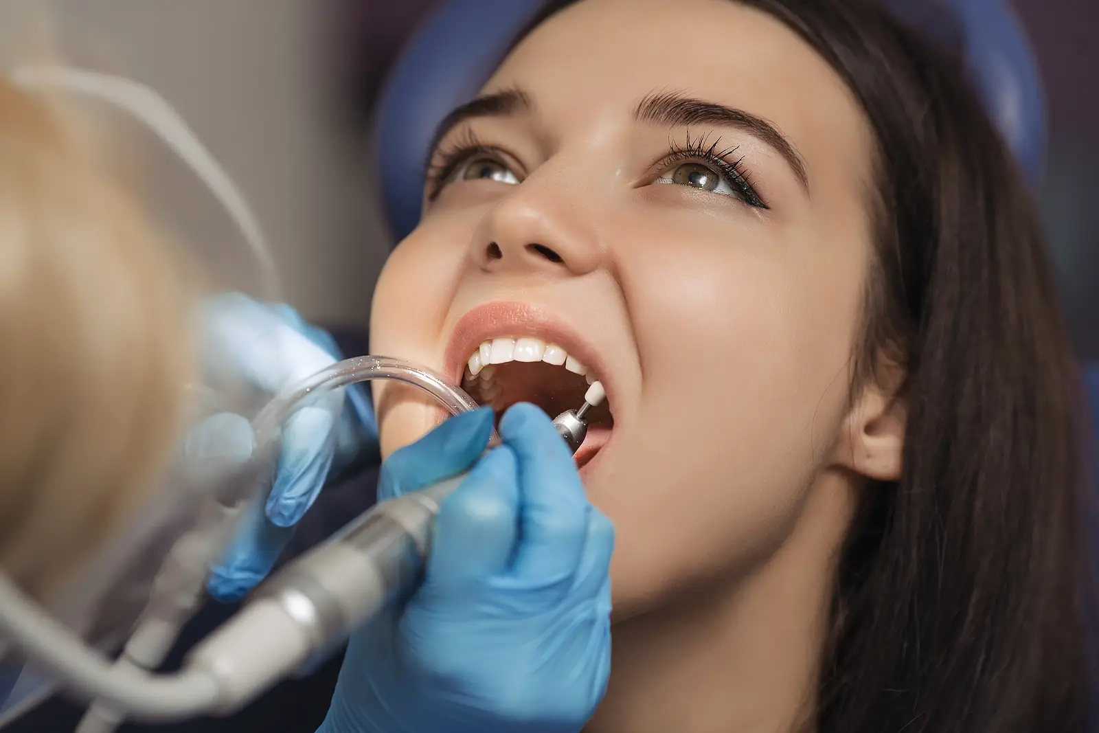 How To Determine the Right Frequency for Your Dental Cleanings