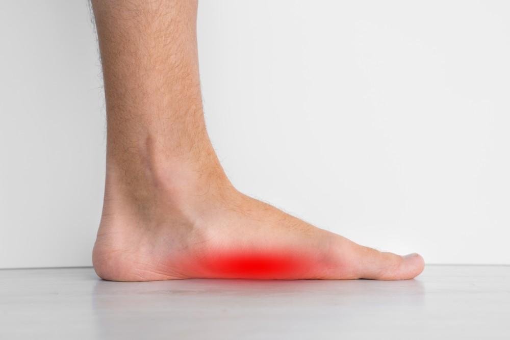 The Impact of Flat Feet on Daily Activities