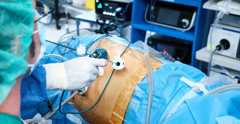 The Role of Laparoscopy in Fertility Treatments