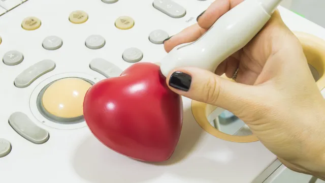 Echocardiograms