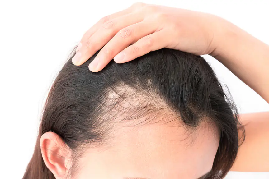 Clinical Factors That Contribute to Hair Thinning in Adults
