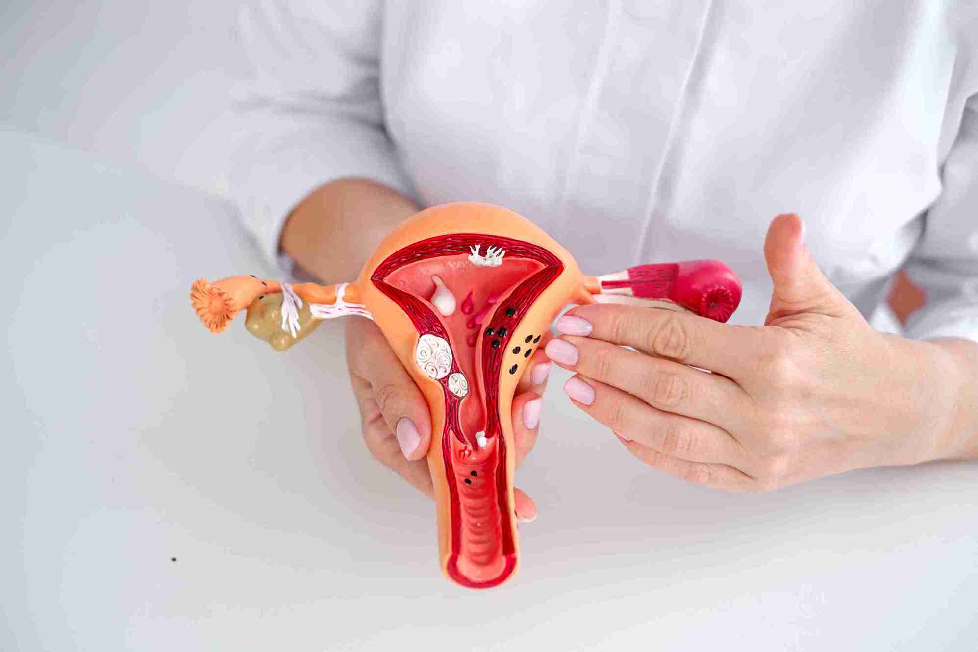 Menstrual Health and Its Role in Gynecology