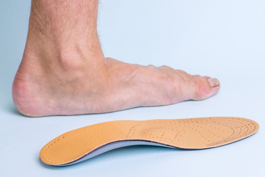Different Treatment Options for Flat Feet