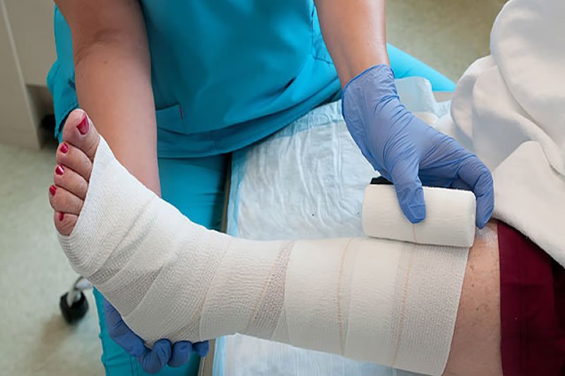Addressing Questions About Wound Care and Healing