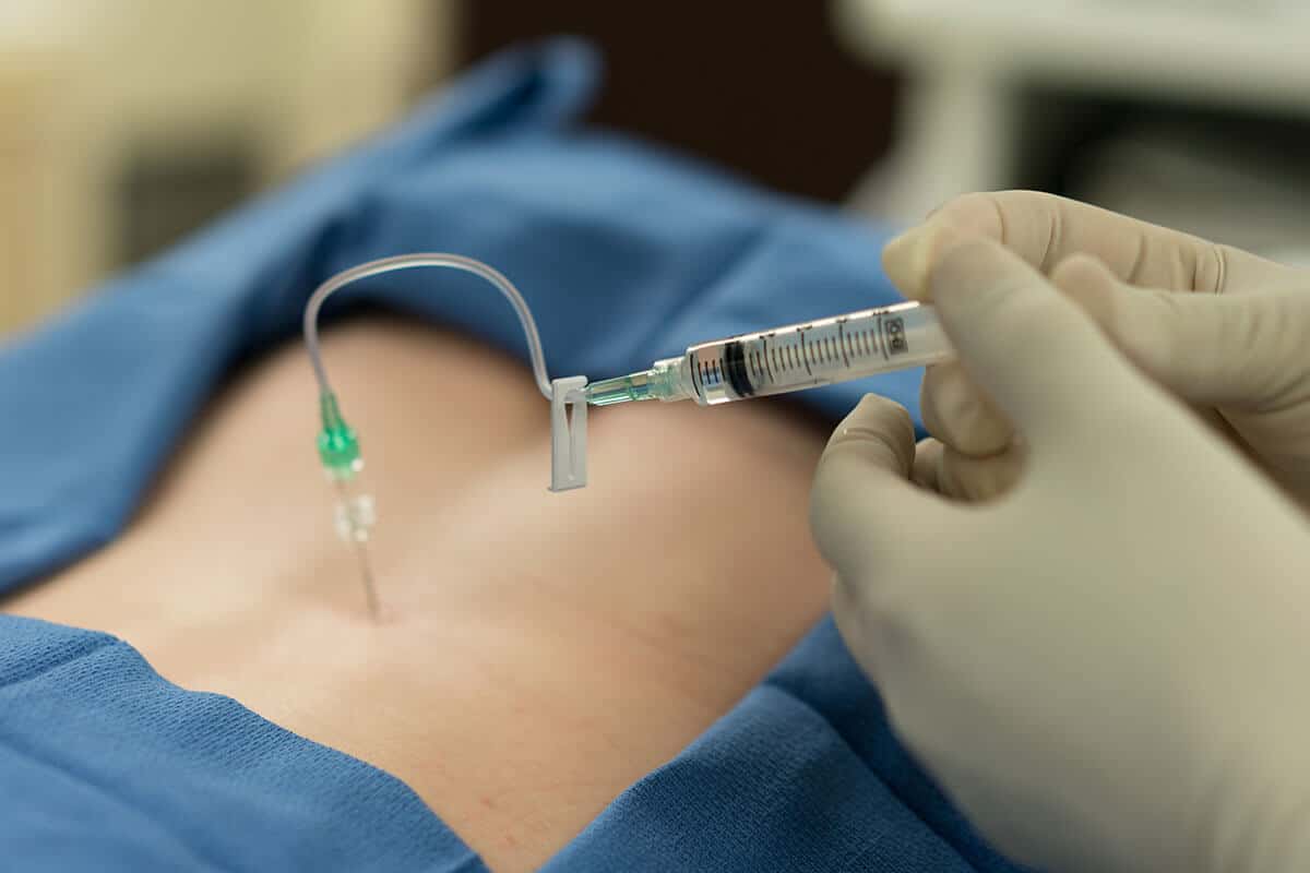 Pain Injection Procedure