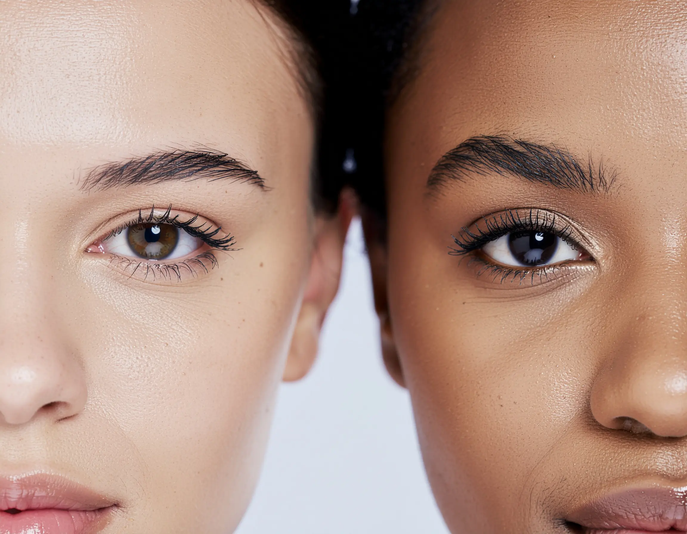 Blepharoplasty in Restoring a Youthful Look